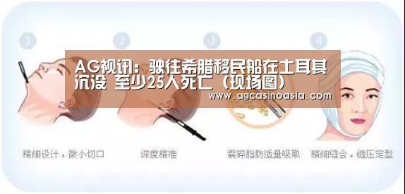 AG在线